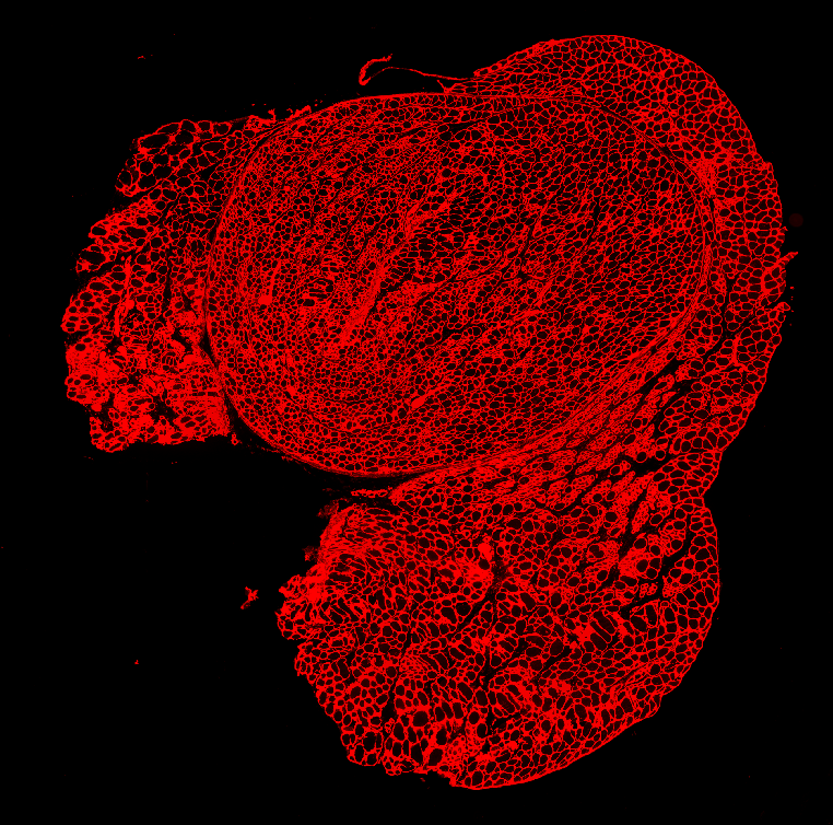 Laminin Muscle Stain