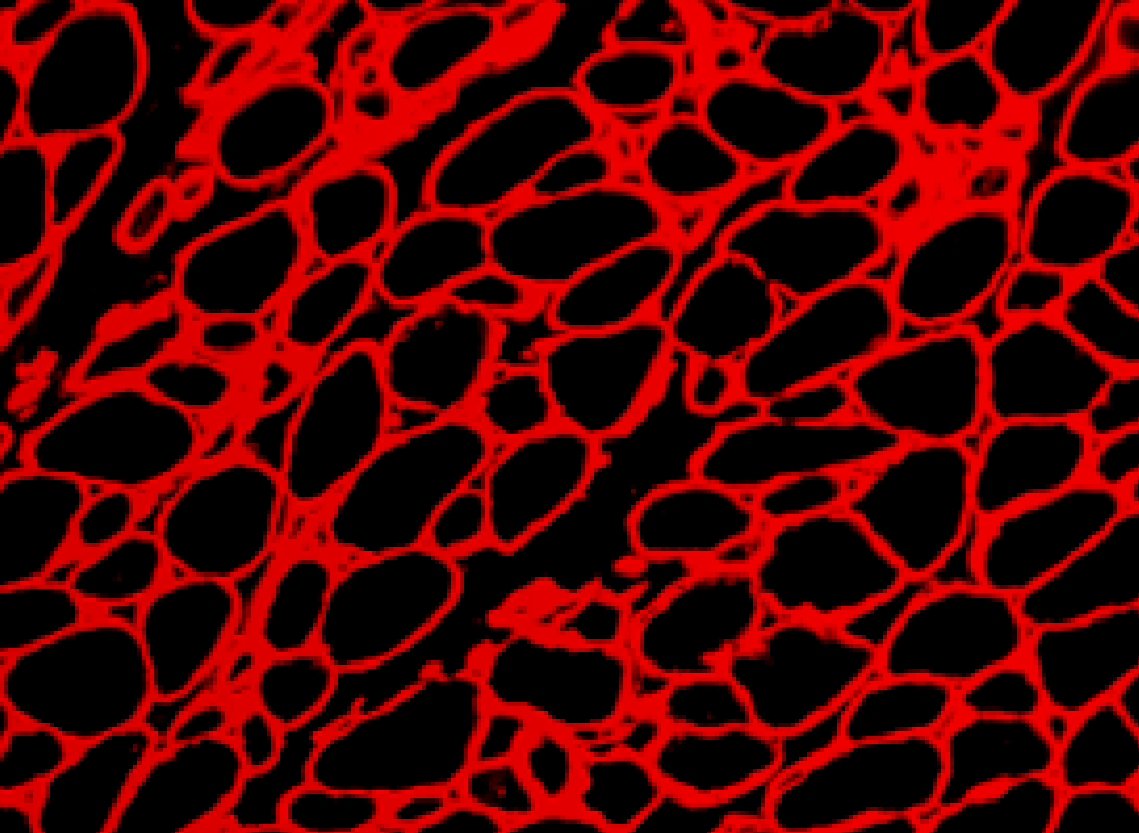 Laminin Muscle Stain Zoomed